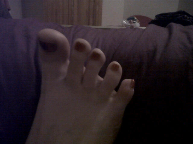 Ex valuable other Inspiring Toes 