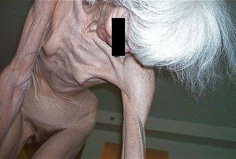 Extremely Skinny And Very Old Hairy Granny Porn Pictures
