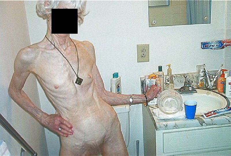 EXTREMELY SKINNY AND VERY OLD HAIRY GRANNY #15429429