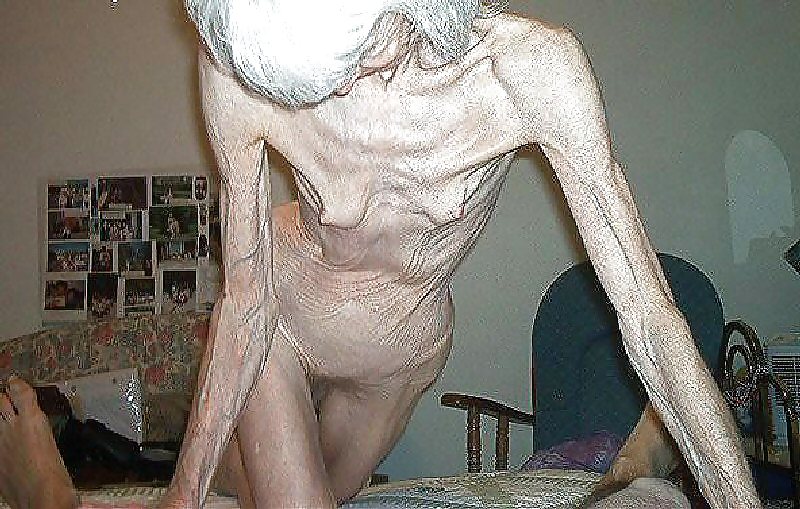 EXTREMELY SKINNY AND VERY OLD HAIRY GRANNY #15429501