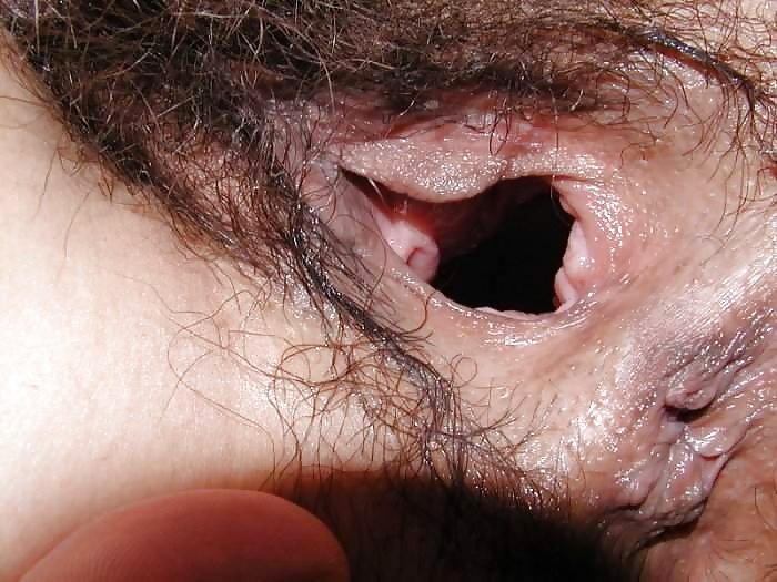 Gaping holes
 #1302080