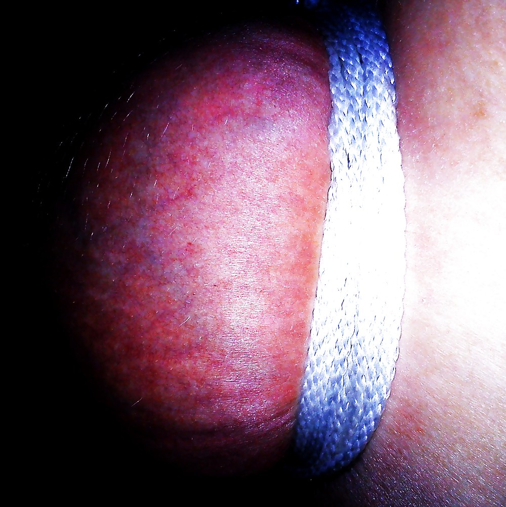 Details #5770896