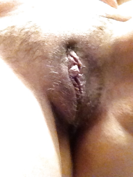 BBW HAIR GROWING BACK #9599296