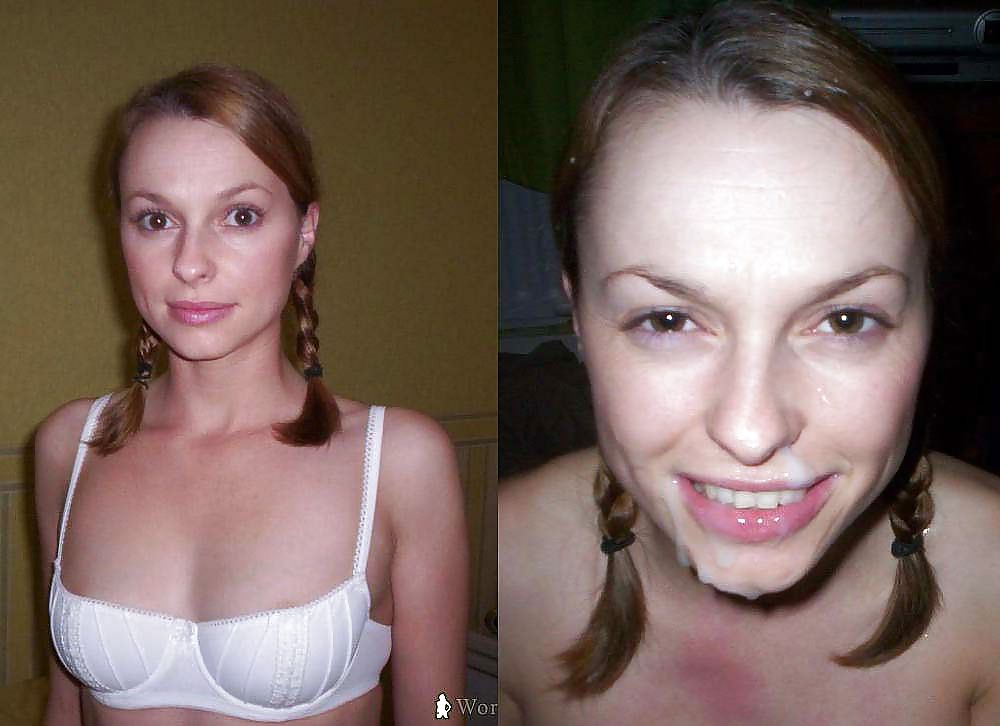 Before After Special Facial - F94 #6342420