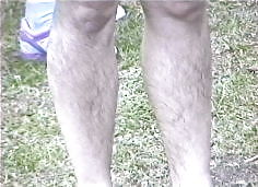 Mujeres con piernas peludas
 #4959036