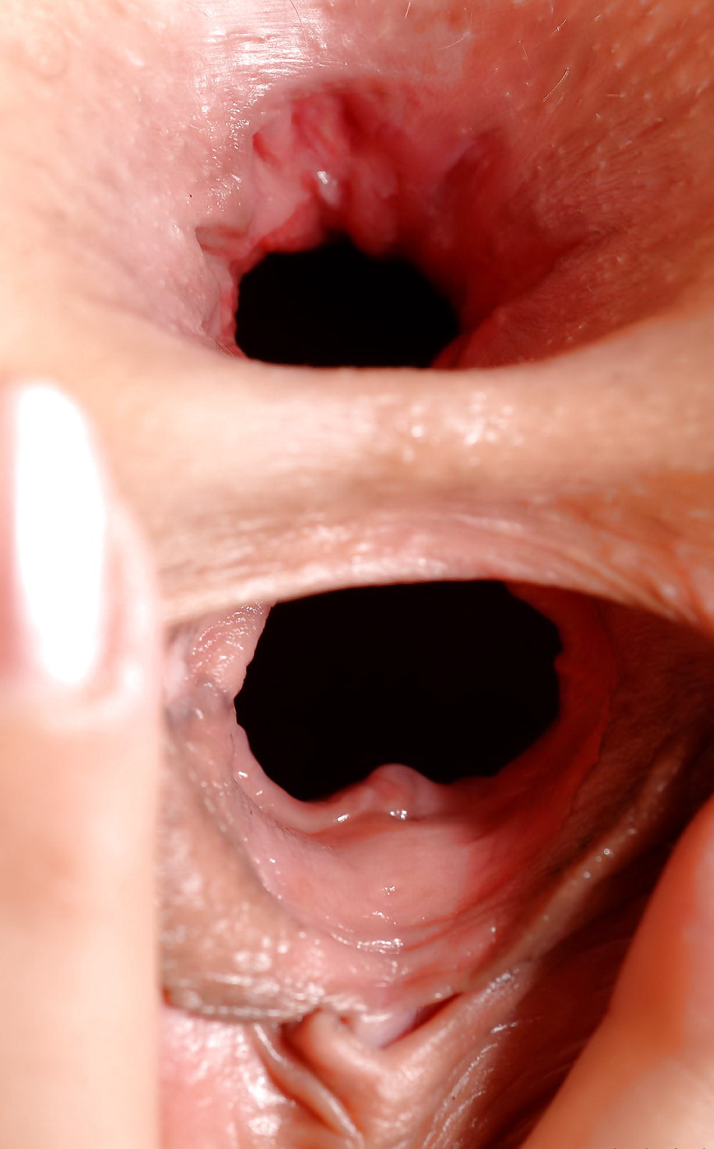 Pussy close-up
 #2845387