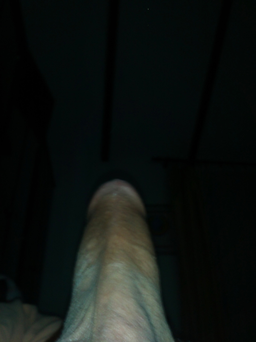 Wenig Pflege #21509802