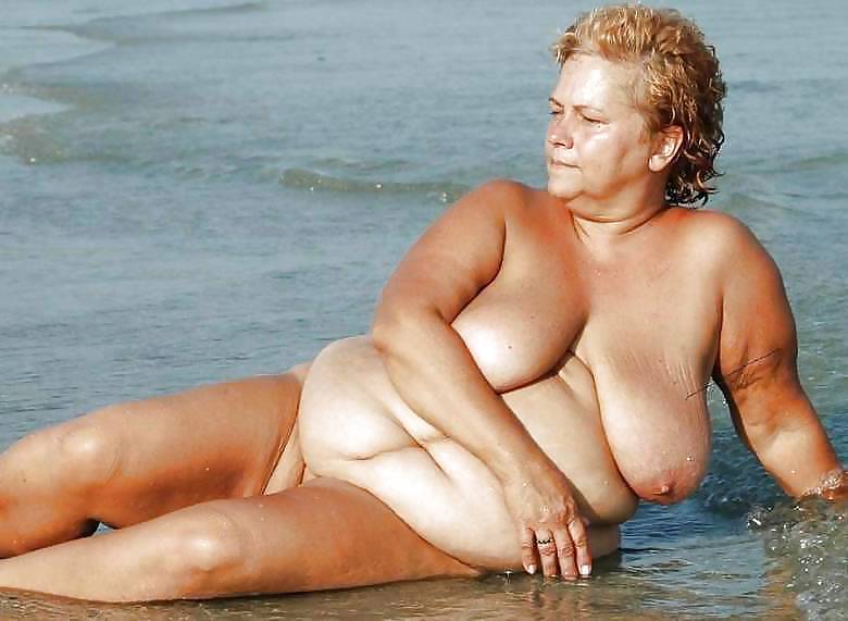 Stretch Marks, Scars and Saggy 21 #14862918