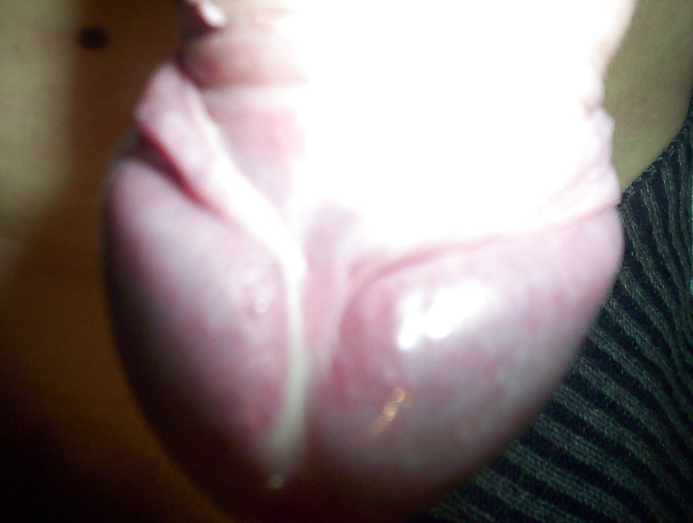 Después de
 #18759095