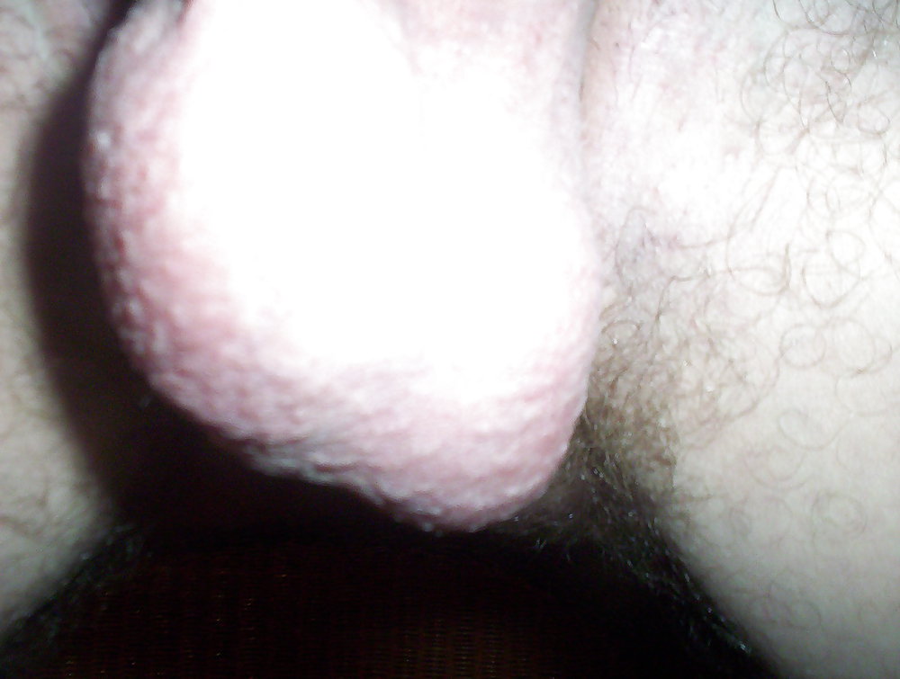 Después de
 #18759209