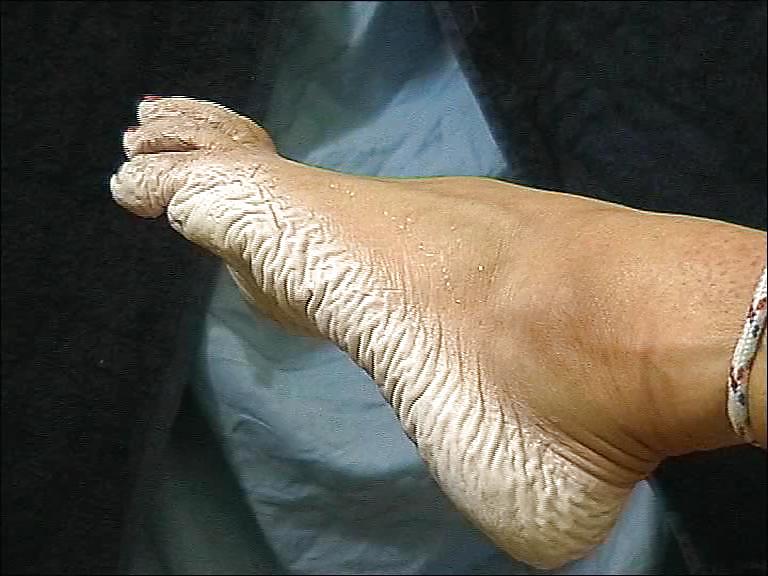Bianca's wet wrinkled feet  #4479622