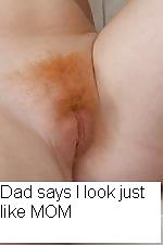 The three red heads  #11905264