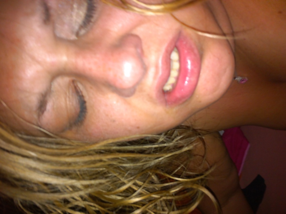 It started to hurt #18710007