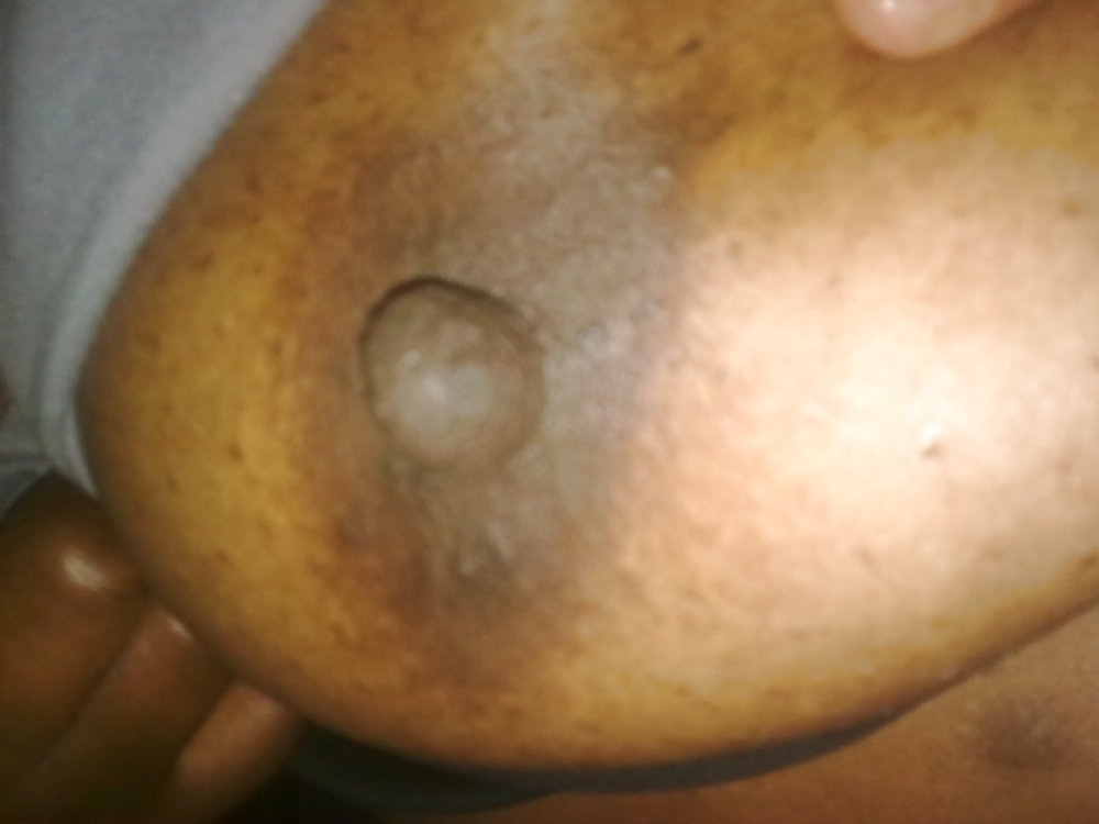 Tbv2 #4323763