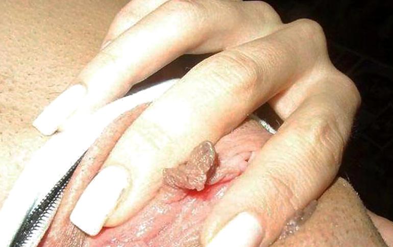 Amateur 9 #4547822