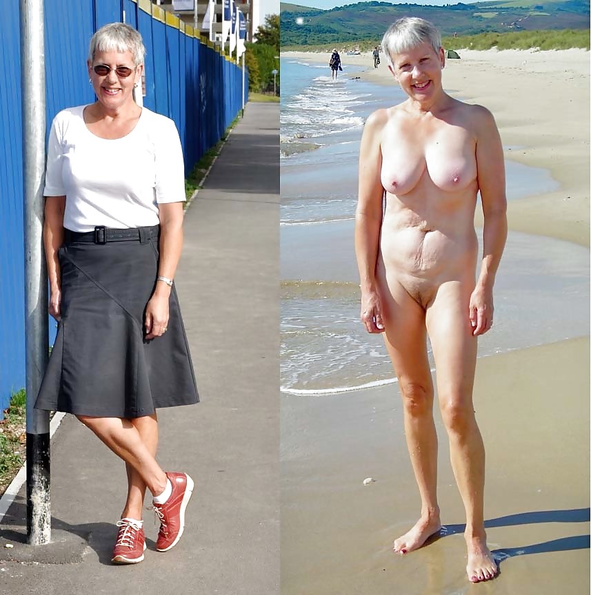 Before after 305 (Older women special). #3586620