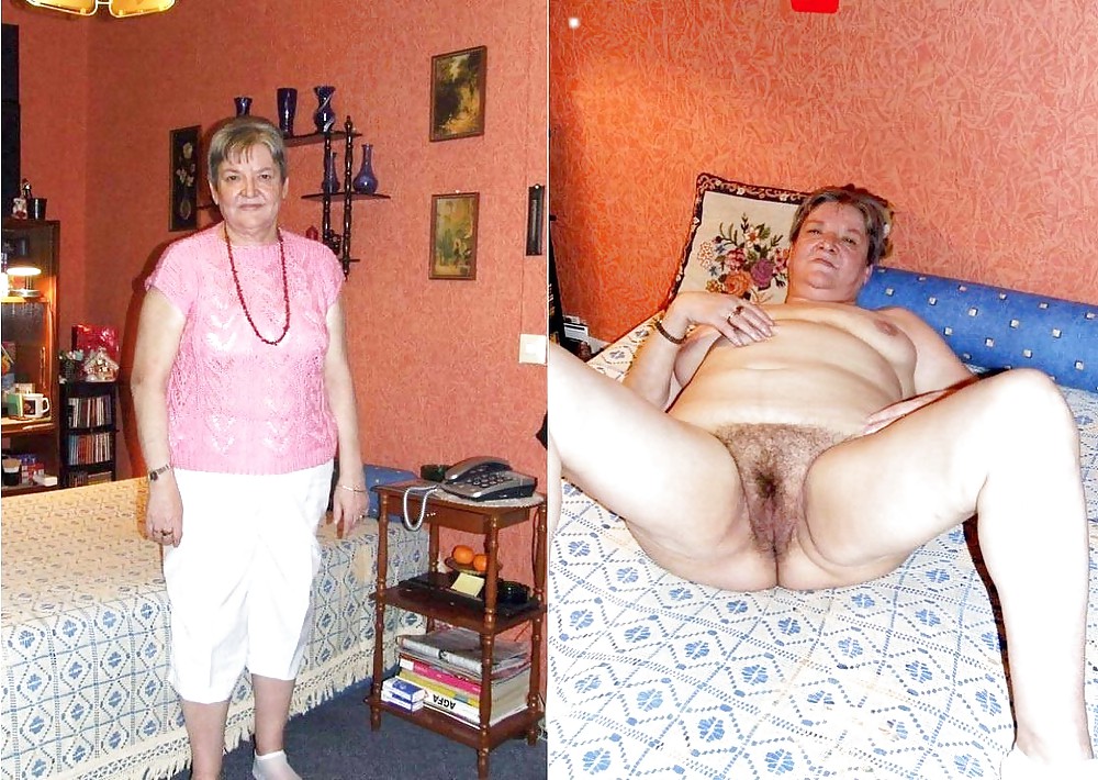 Before after 305 (Older women special). #3586632