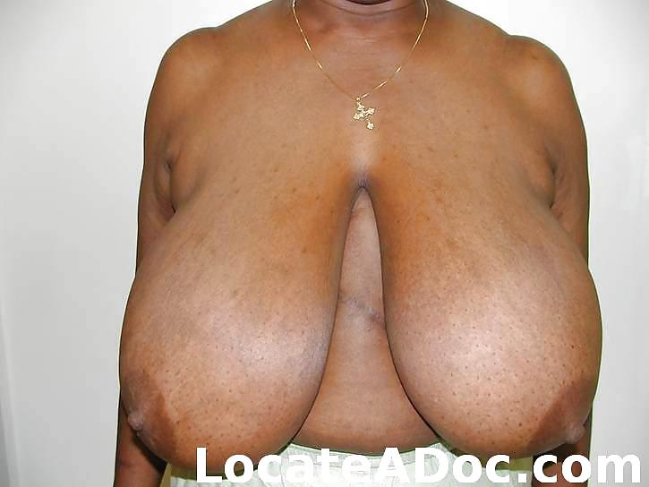 B (r) E (a) St Der Reduktion #20182378