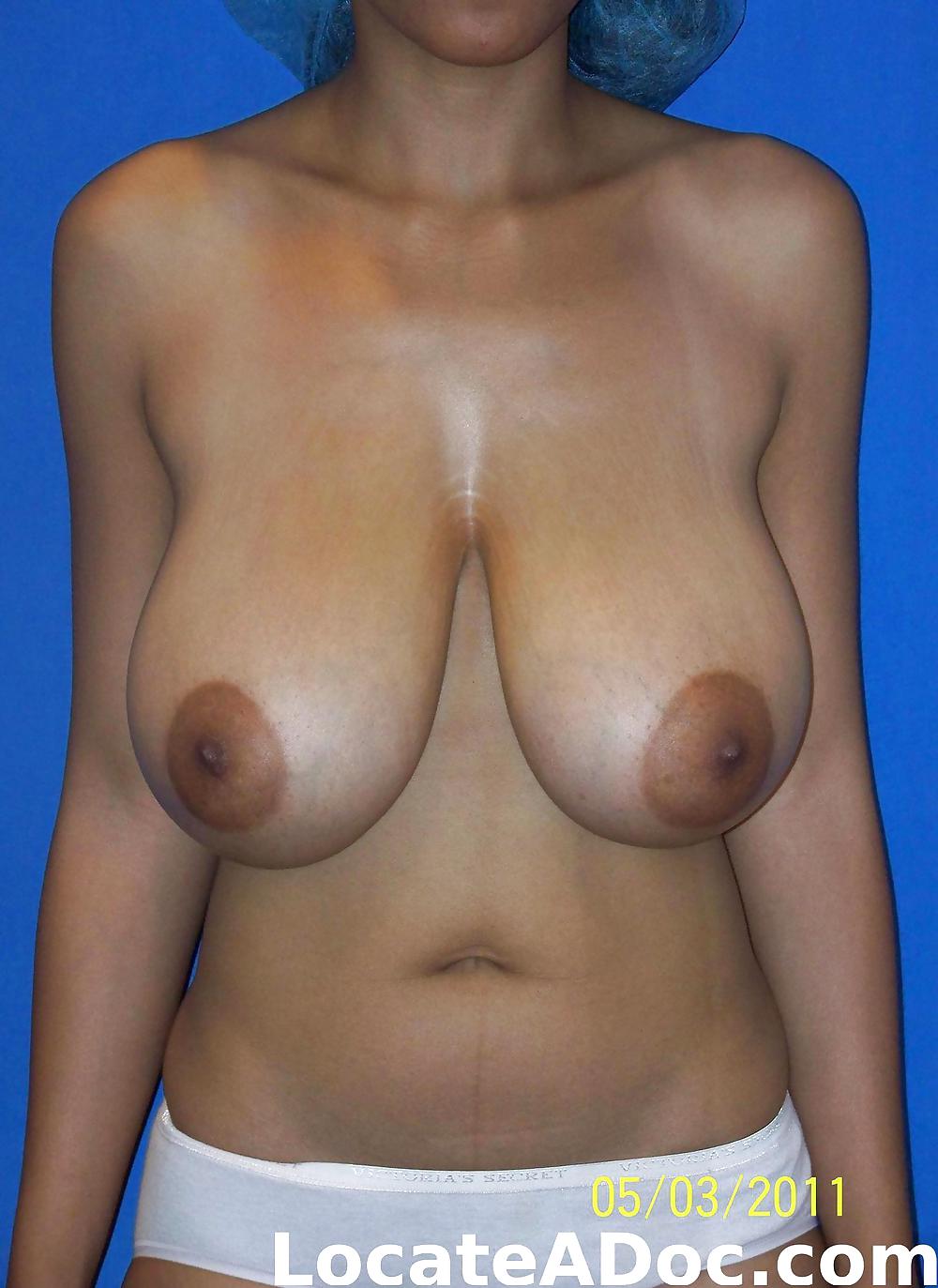 B (r) E (a) St Der Reduktion #20182478