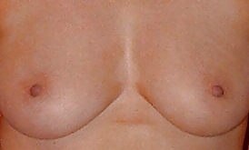 My beautiful tits  #22410451