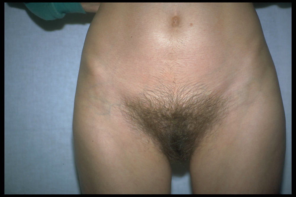 Furry mothers to be 2 #9470753