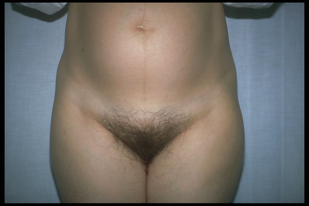 Furry mothers to be 2 #9470759