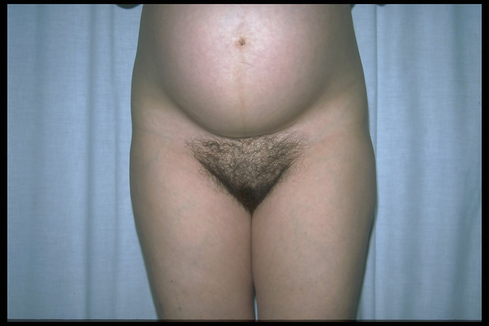 Furry mothers to be 2 #9470781