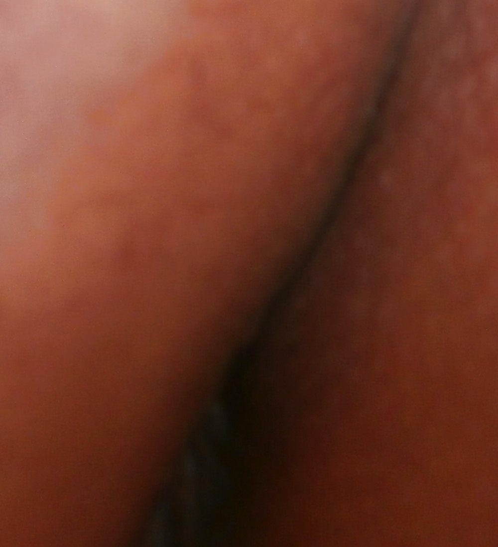 New butthole pics #16600512