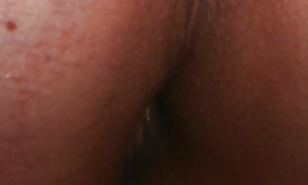 New butthole pics #16600571