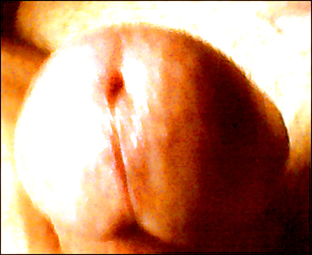 Impish pau maranhense caiu na fetch