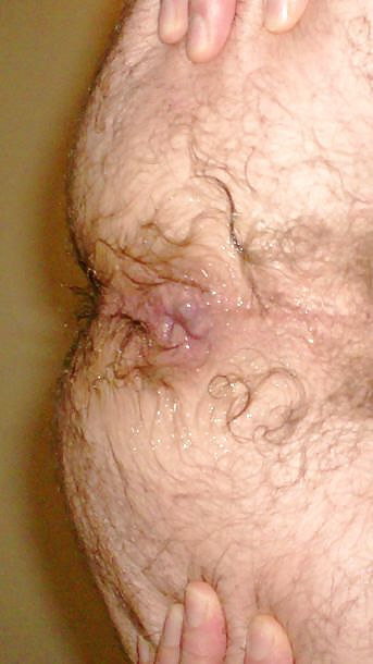 アナル舐め
 #1599907