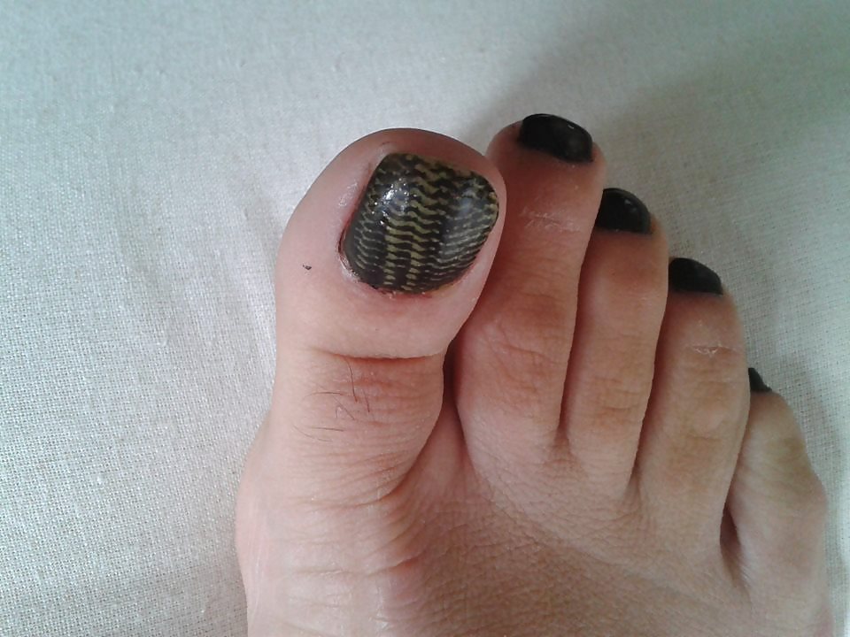 Mi elección
 #18047022