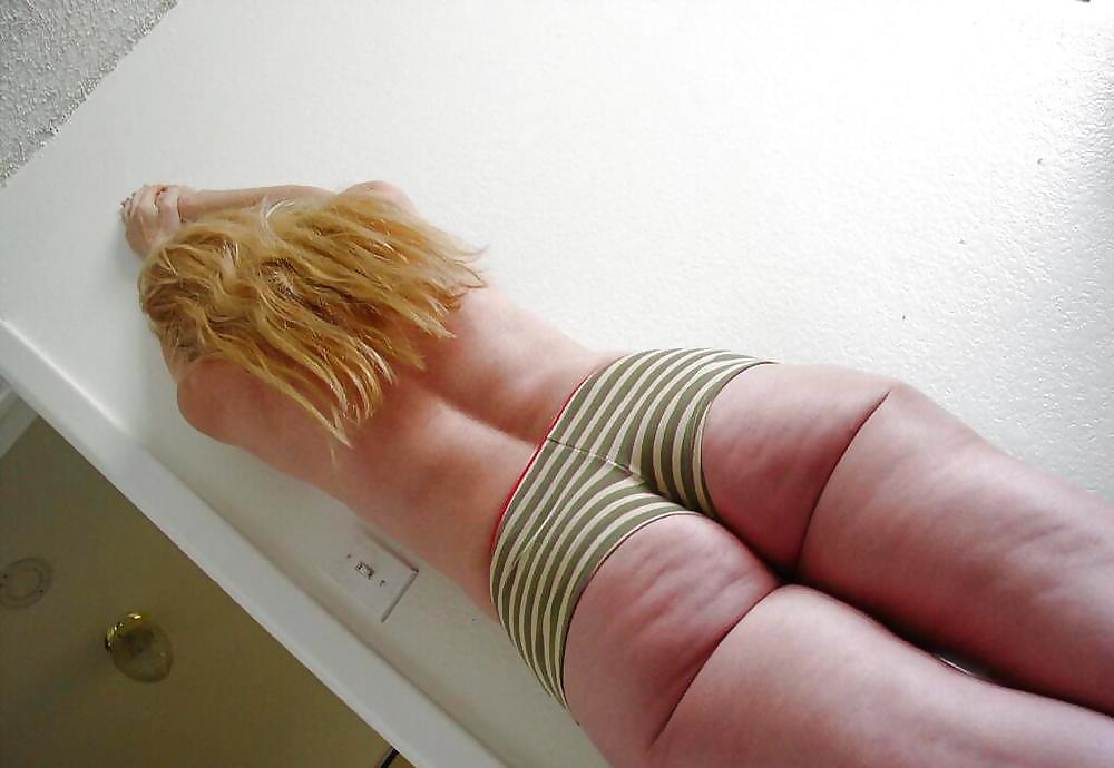 Cellulite All Stars  #9632040