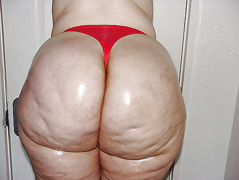 Cellulite All Stars  #9632156