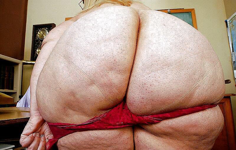 Cellulite All Stars  #9632186