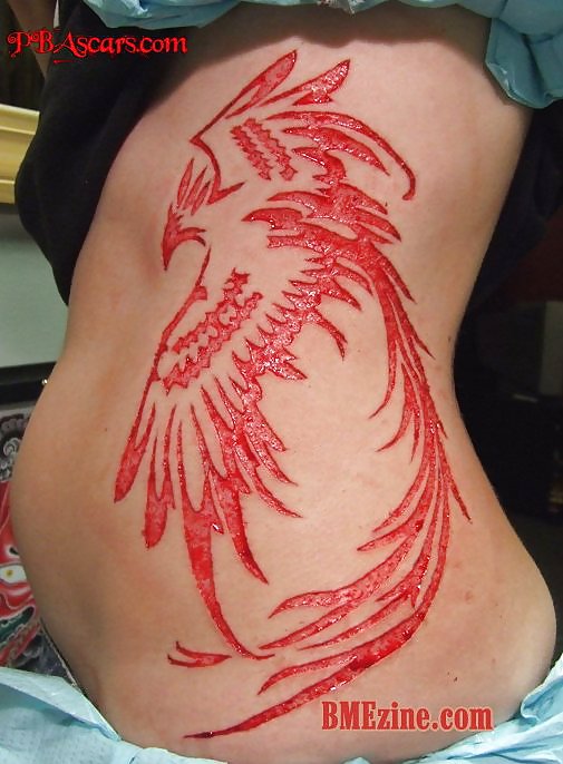 Teens and  Scarification -  Body Modification #16099020