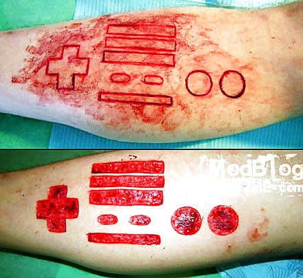 Teens and  Scarification -  Body Modification #16099113