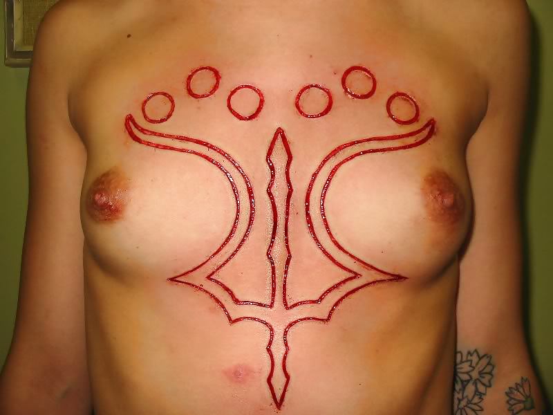 Teens and  Scarification -  Body Modification #16099135