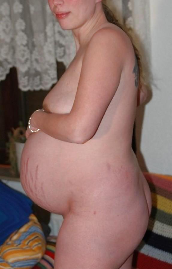 Pregnant Stretchmarks #19559448