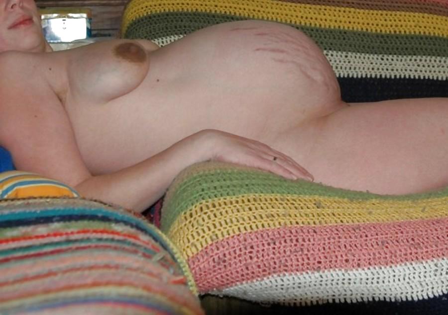 Pregnant Stretchmarks #19559478