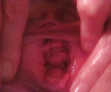 Pussy Close-Ups #4456201