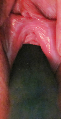 Pussy Close-Ups #4456215