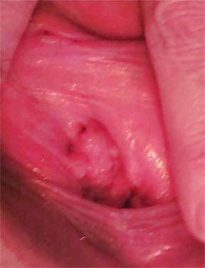 Pussy Close-Ups #4456217