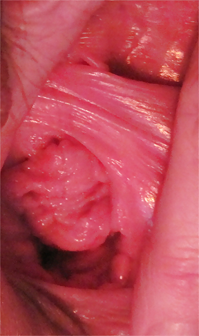 Pussy Close-Ups #4456223