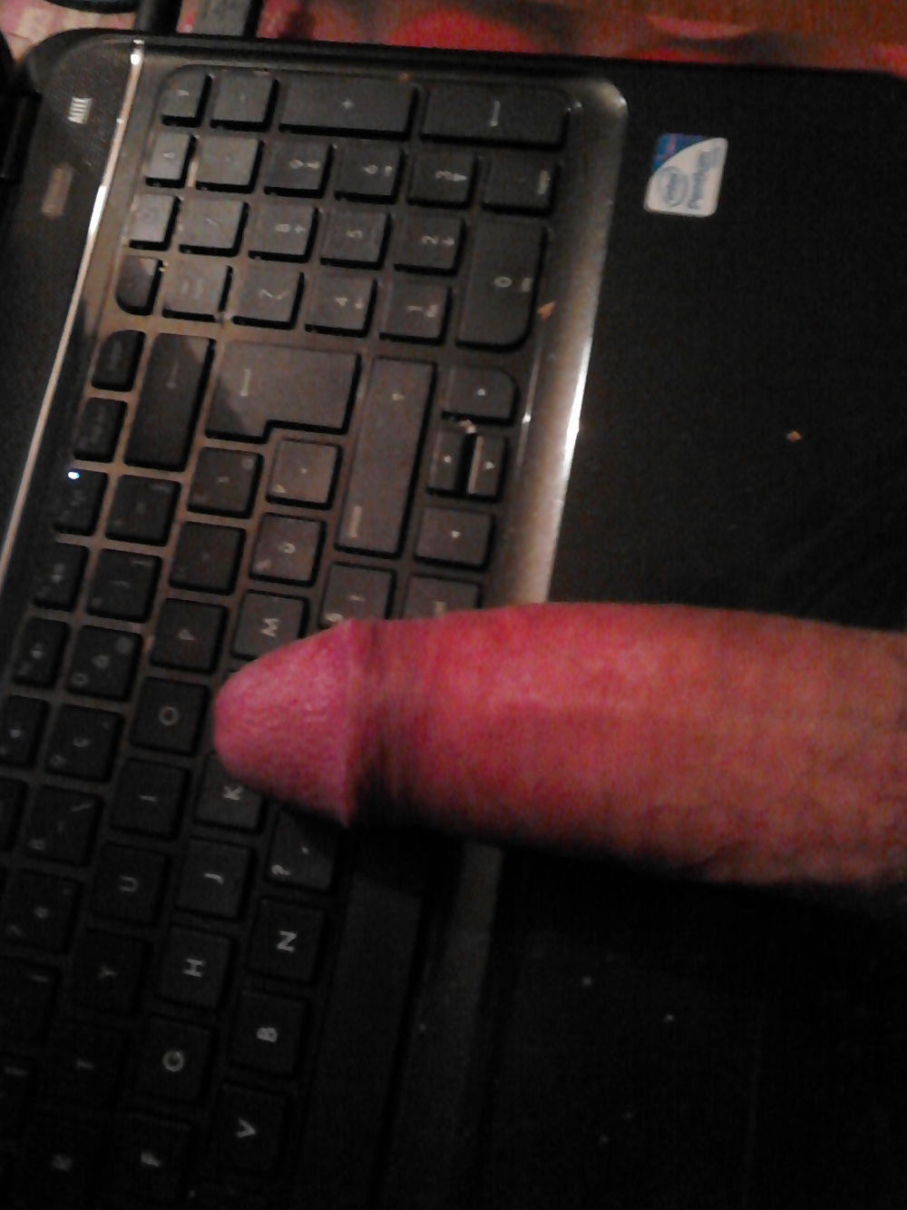MA BITE #20075665