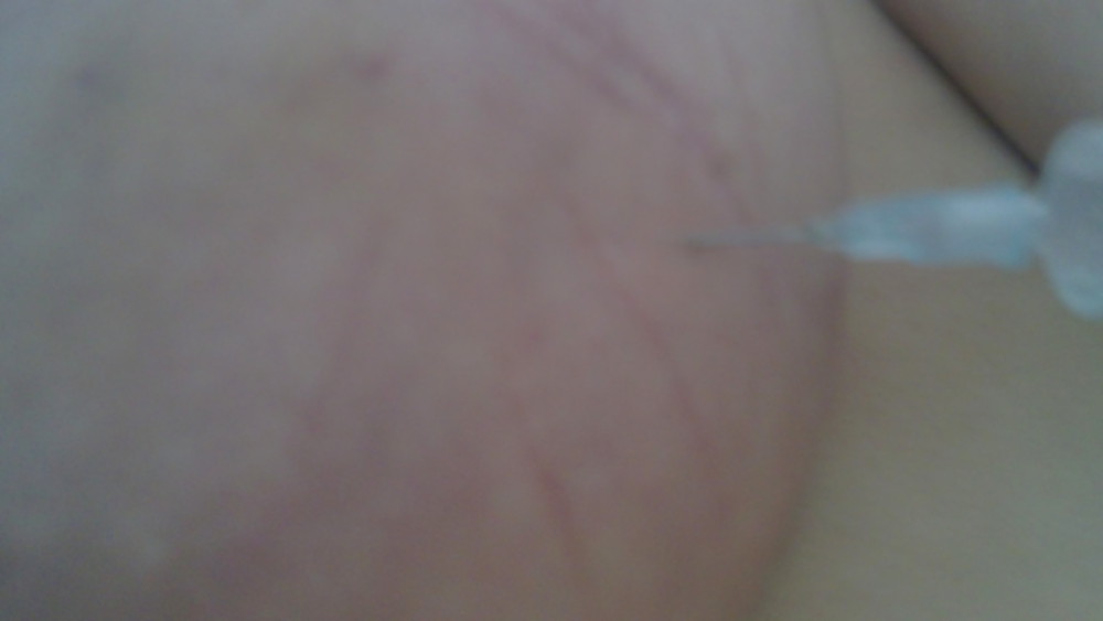 Scottish slut self harm #3587289