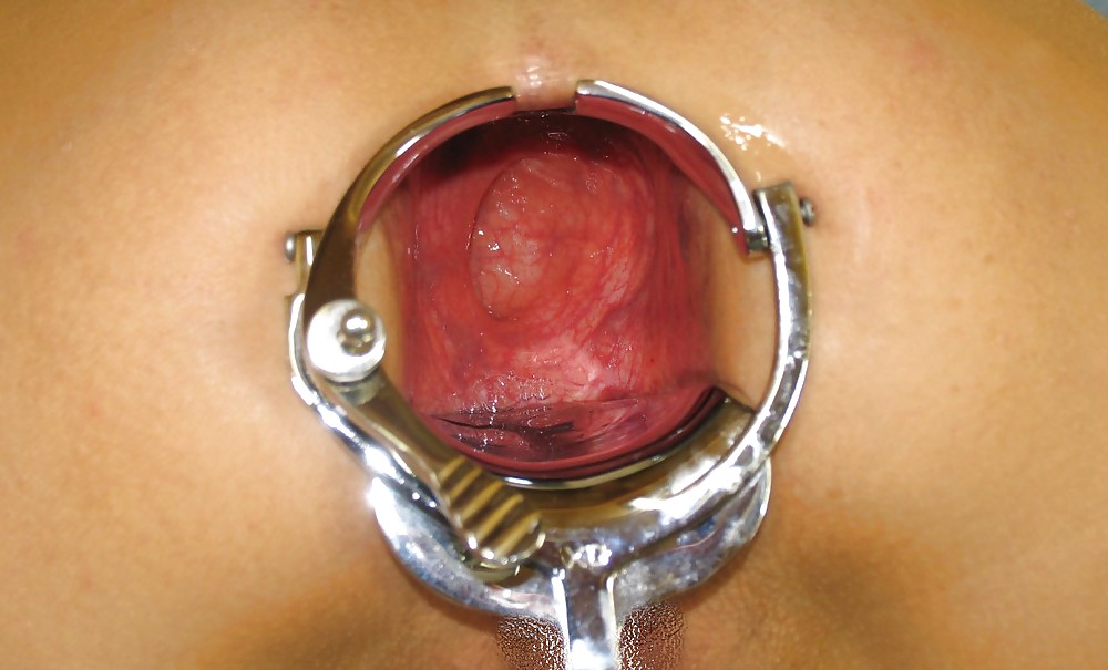 Pictures of incredible anal insertions by M.D.F.