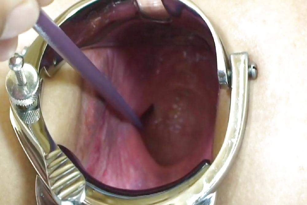 Pictures of incredible anal insertions by M.D.F. #10266305