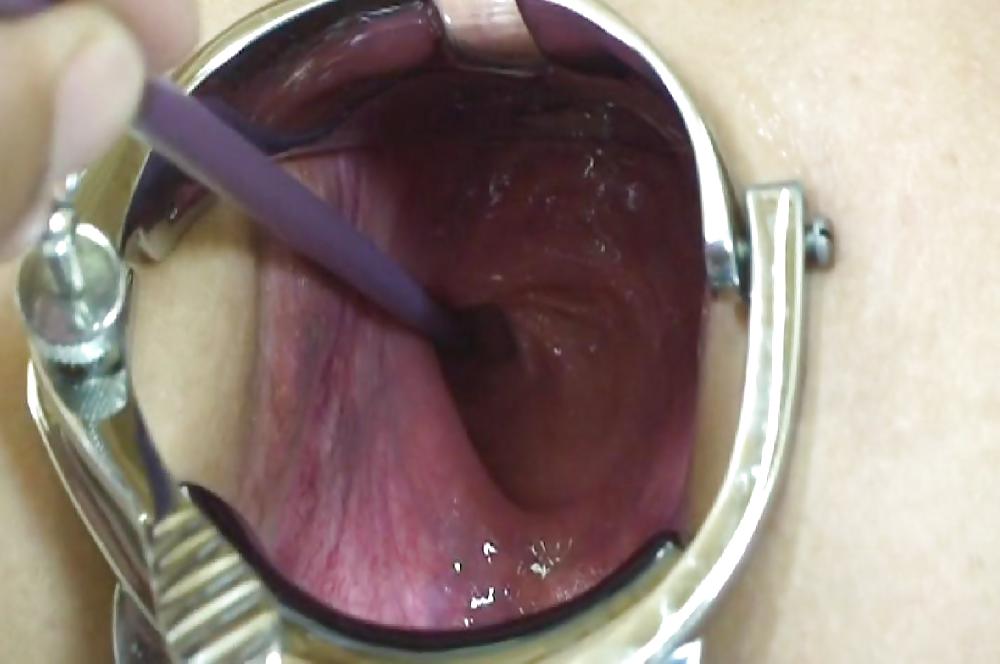 Pictures of incredible anal insertions by M.D.F. #10266308