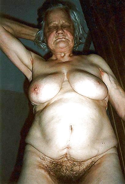 Stretch Marks, Scars and Saggy 22 #16615963